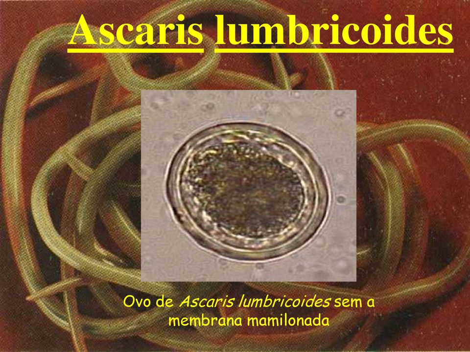 de  lumbricoides