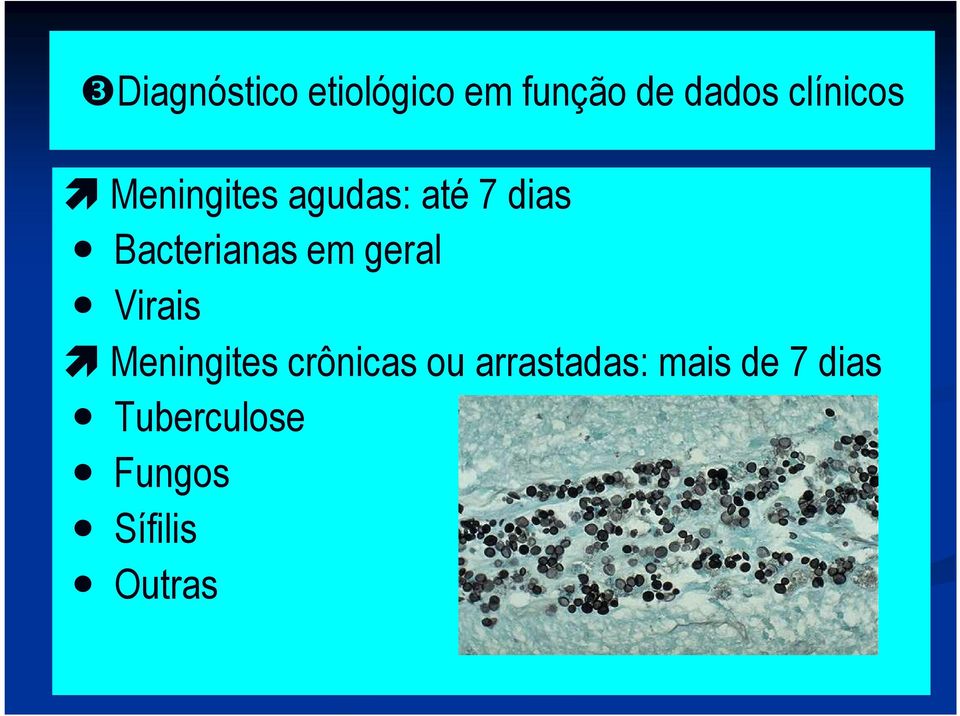 Bacterianas em geral Virais Meningites crônicas