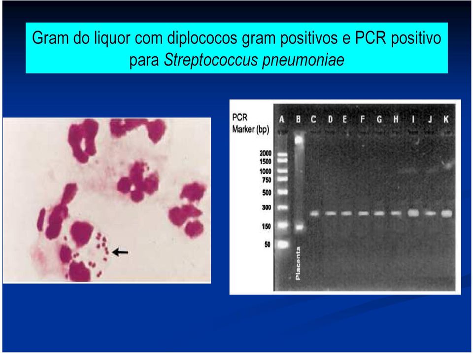 positivos e PCR