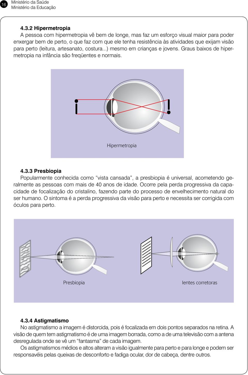 para perto (leitura, artesanato, costura...) mesmo em crianças e jovens. Graus baixos de hipermetropia na infância são freqüentes e normais. Hipermetropia 4.3.