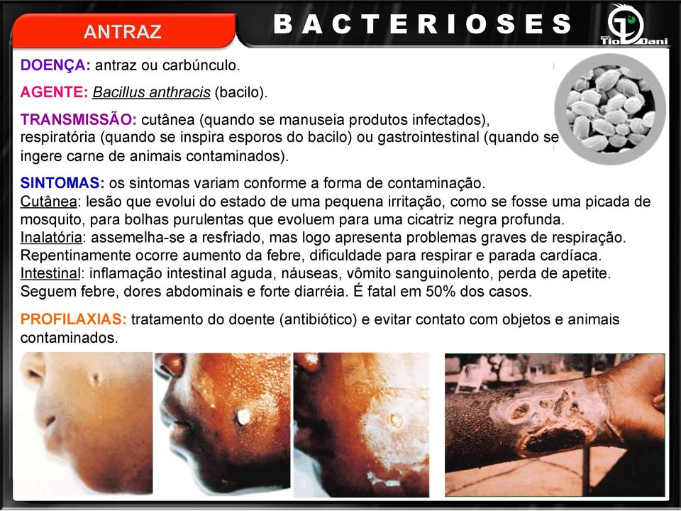 SINTOMAS: os sintomas variam conforme a forma de contaminação.