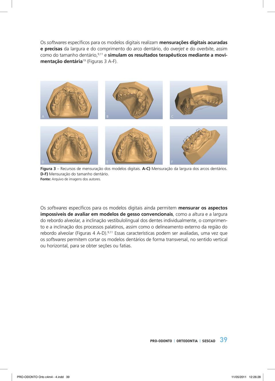 A-C) Mensuração da largura dos arcos dentários. D-F) Mensuração do tamanho dentário. Fonte: Arquivo de imagens dos autores.