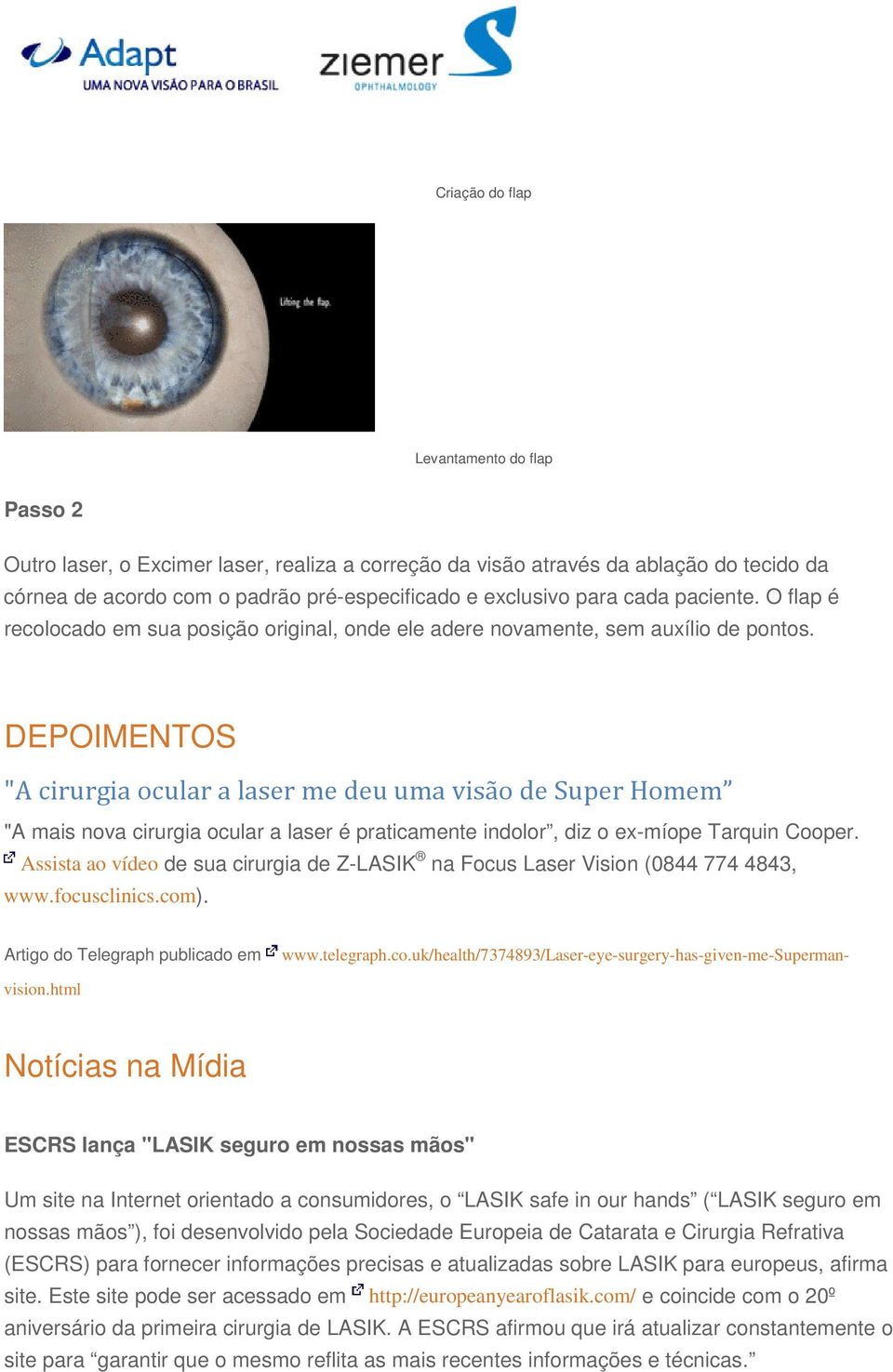 DEPOIMENTOS "A cirurgia ocular a laser me deu uma visão de Super Homem "A mais nova cirurgia ocular a laser é praticamente indolor, diz o ex-míope Tarquin Cooper.