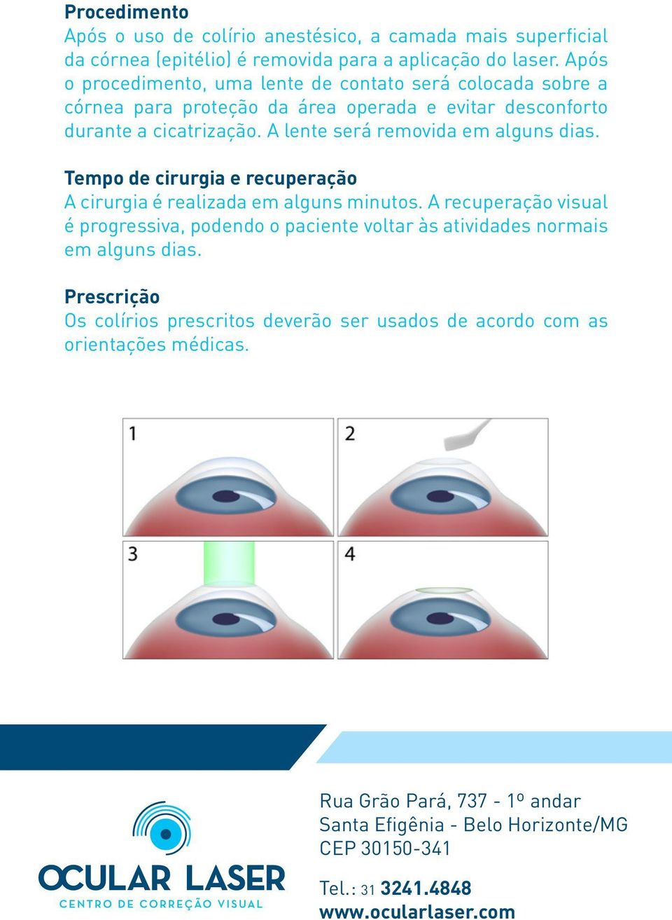 A lente será removida em alguns dias. Tempo de cirurgia e recuperação A cirurgia é realizada em alguns minutos.