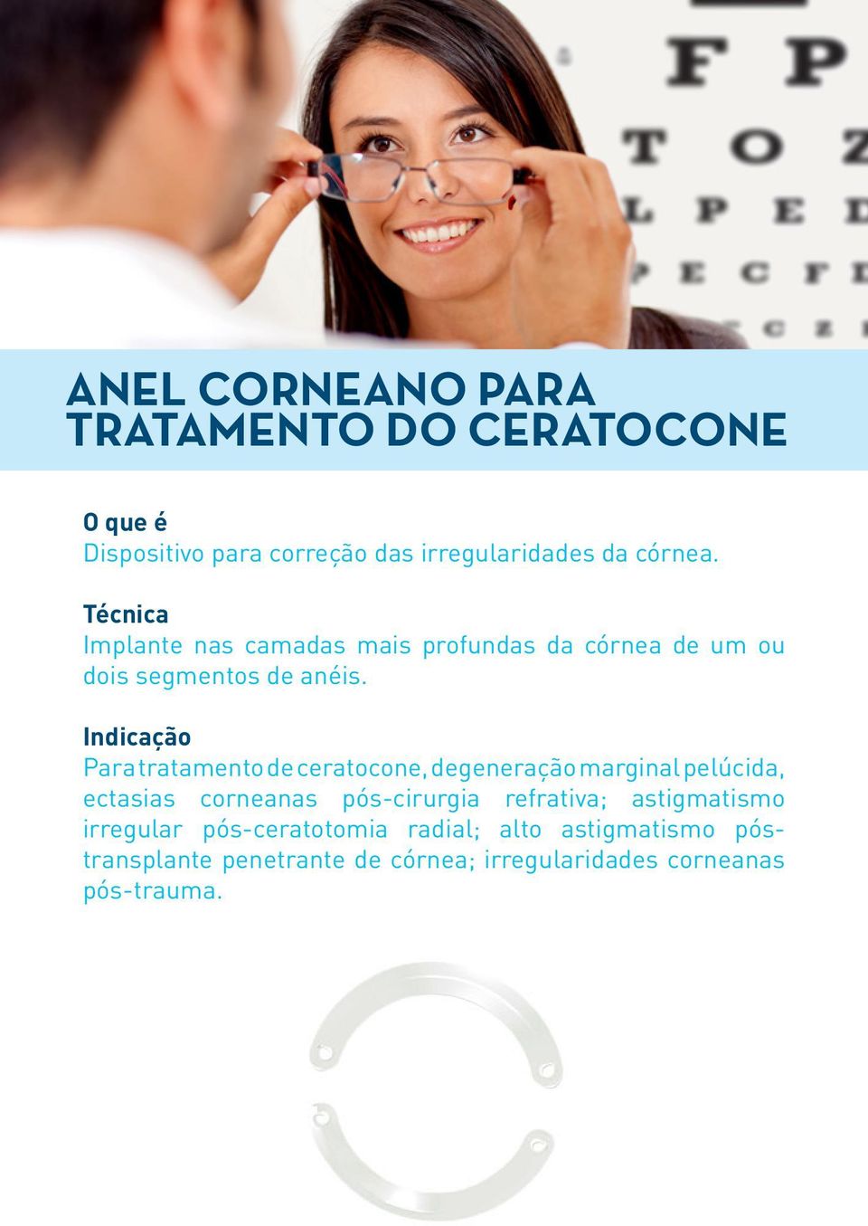 Indicação Para tratamento de ceratocone, degeneração marginal pelúcida, ectasias corneanas pós-cirurgia