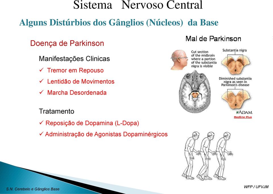 Movimentos Marcha Desordenada Tratamento Reposição de Dopamina (L-Dopa)