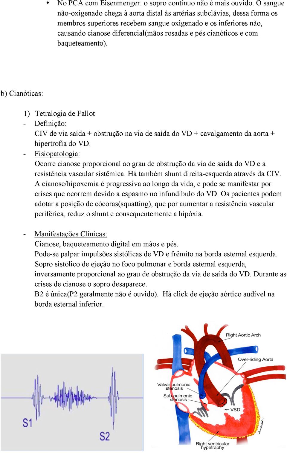 cianóticos e com baqueteamento). b) Cianóticas: 1) Tetralogia de Fallot - Definição: CIV de via saída + obstrução na via de saída do VD + cavalgamento da aorta + hipertrofia do VD.