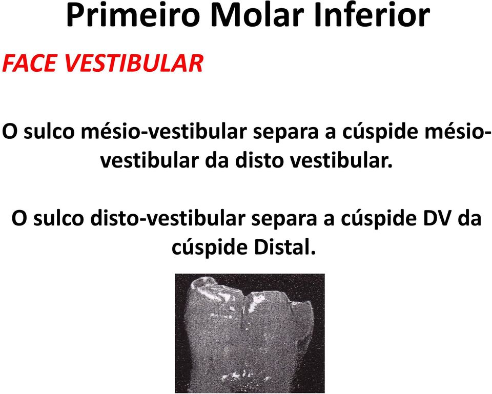 mésiovestibular da disto vestibular.