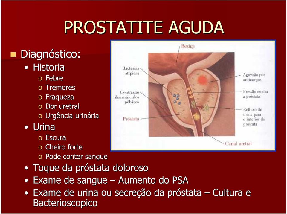 Pode conter sangue Toque da próstata doloroso Exame de sangue