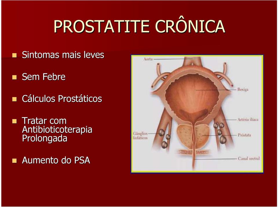 Prostáticos Tratar com