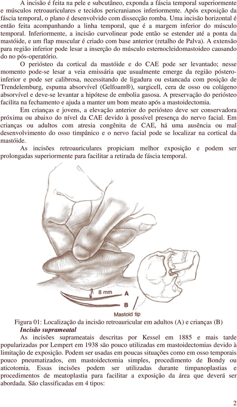 Inferiormente, a incisão curvolinear pode então se estender até a ponta da mastóide, e um flap muscular é criado com base anterior (retalho de Palva).