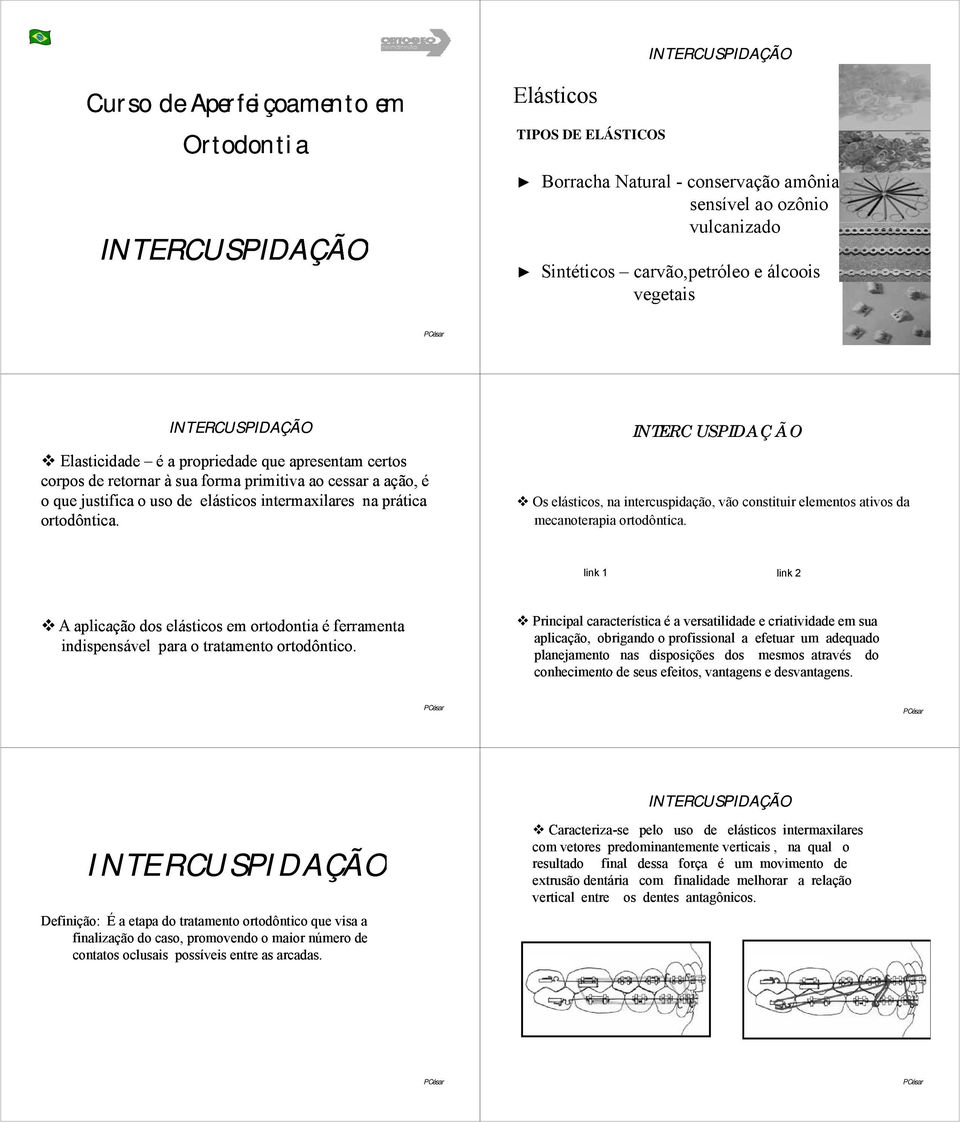 Os elásticos, na intercuspidação, vão constituir elementos ativos da mecanoterapia ortodôntica.