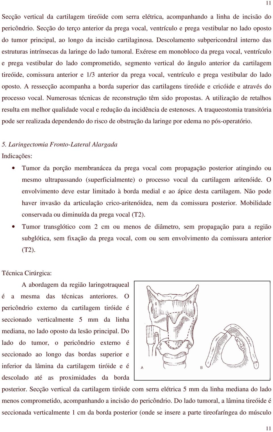 Descolamento subpericondral interno das estruturas intrínsecas da laringe do lado tumoral.