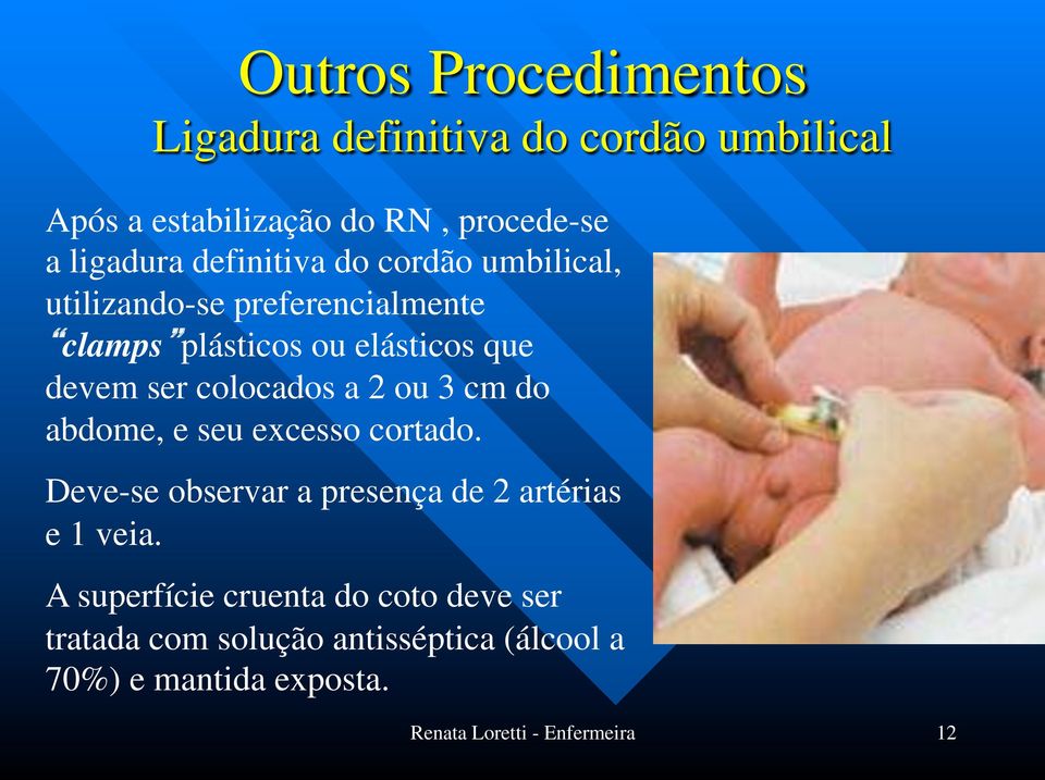 colocados a 2 ou 3 cm do abdome, e seu excesso cortado. Deve-se observar a presença de 2 artérias e 1 veia.