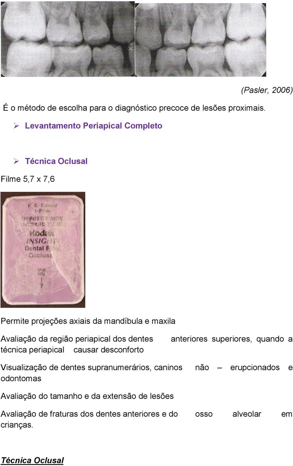 Avaliação da região periapical dos dentes técnica periapical causar desconforto anteriores superiores, quando a Visualização de