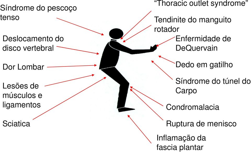 Tendinite do manguito rotador Enfermidade de DeQuervain Dedo em gatilho