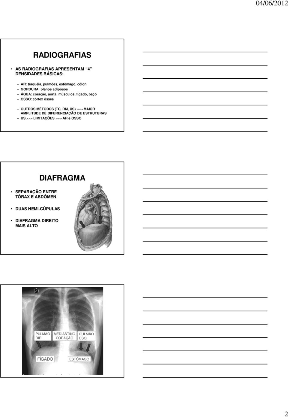 MAIOR AMPLITUDE DE DIFERENCIAÇÃO DE ESTRUTURAS US >>> LIMITAÇÕES >>> AR e OSSO DIAFRAGMA SEPARAÇÃO ENTRE TÓRAX E