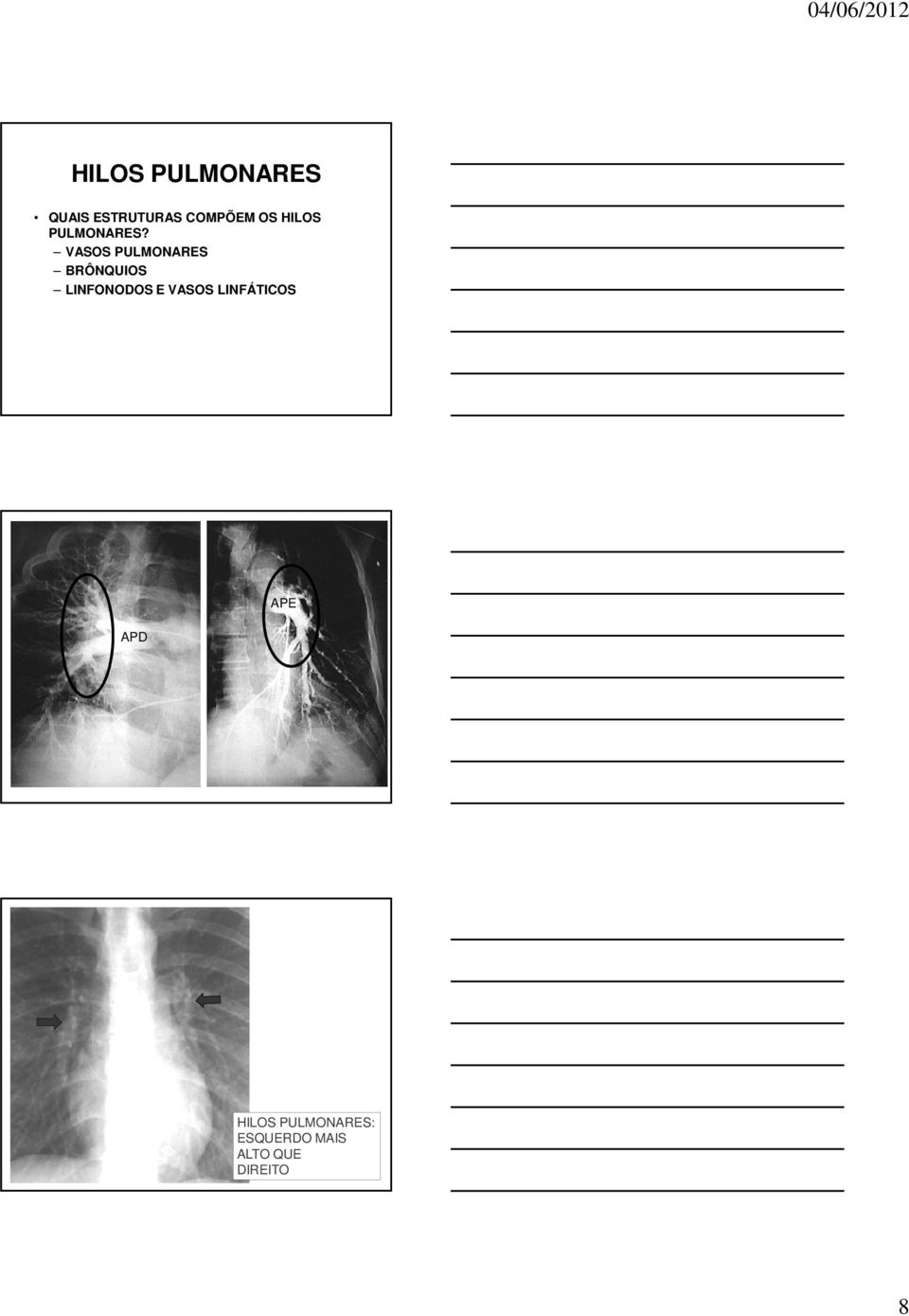 VASOS PULMONARES BRÔNQUIOS LINFONODOS E