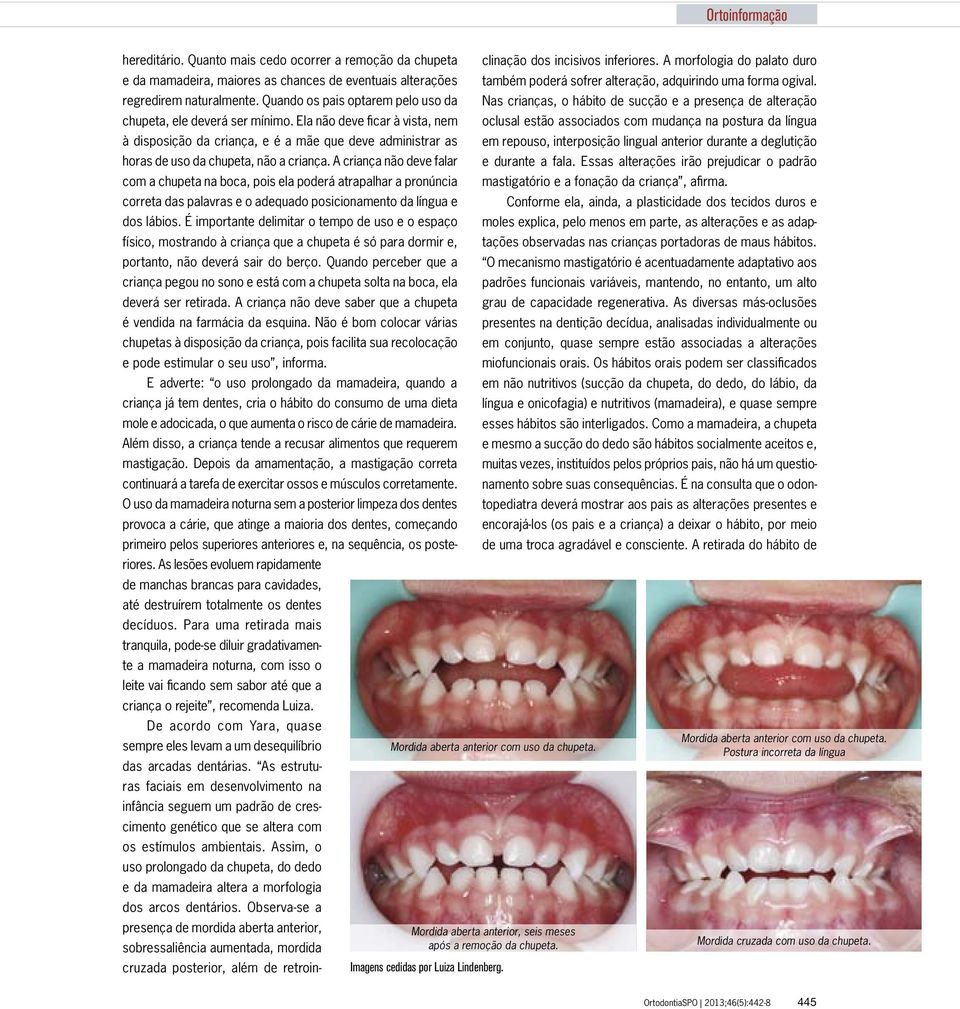 A criança não deve falar com a chupeta na boca, pois ela poderá atrapalhar a pronúncia correta das palavras e o adequado posicionamento da língua e dos lábios.