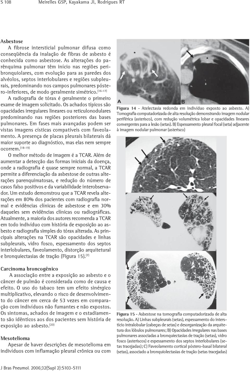 pulmonares póstero-inferiores, de modo geralmente simétrico. (16-17) A radiografia de tórax é geralmente o primeiro exame de imagem solicitado.