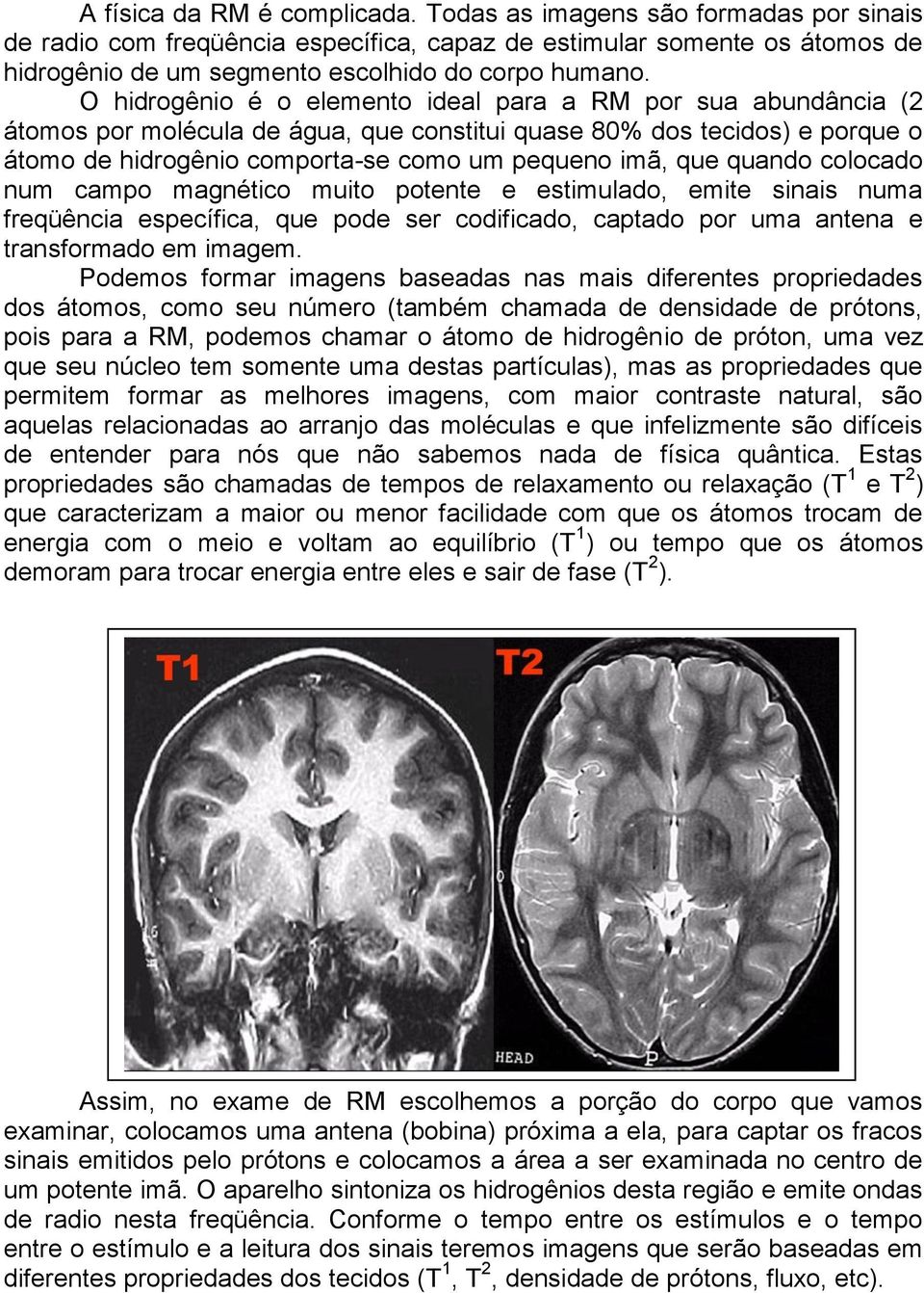 quando colocado num campo magnético muito potente e estimulado, emite sinais numa freqüência específica, que pode ser codificado, captado por uma antena e transformado em imagem.