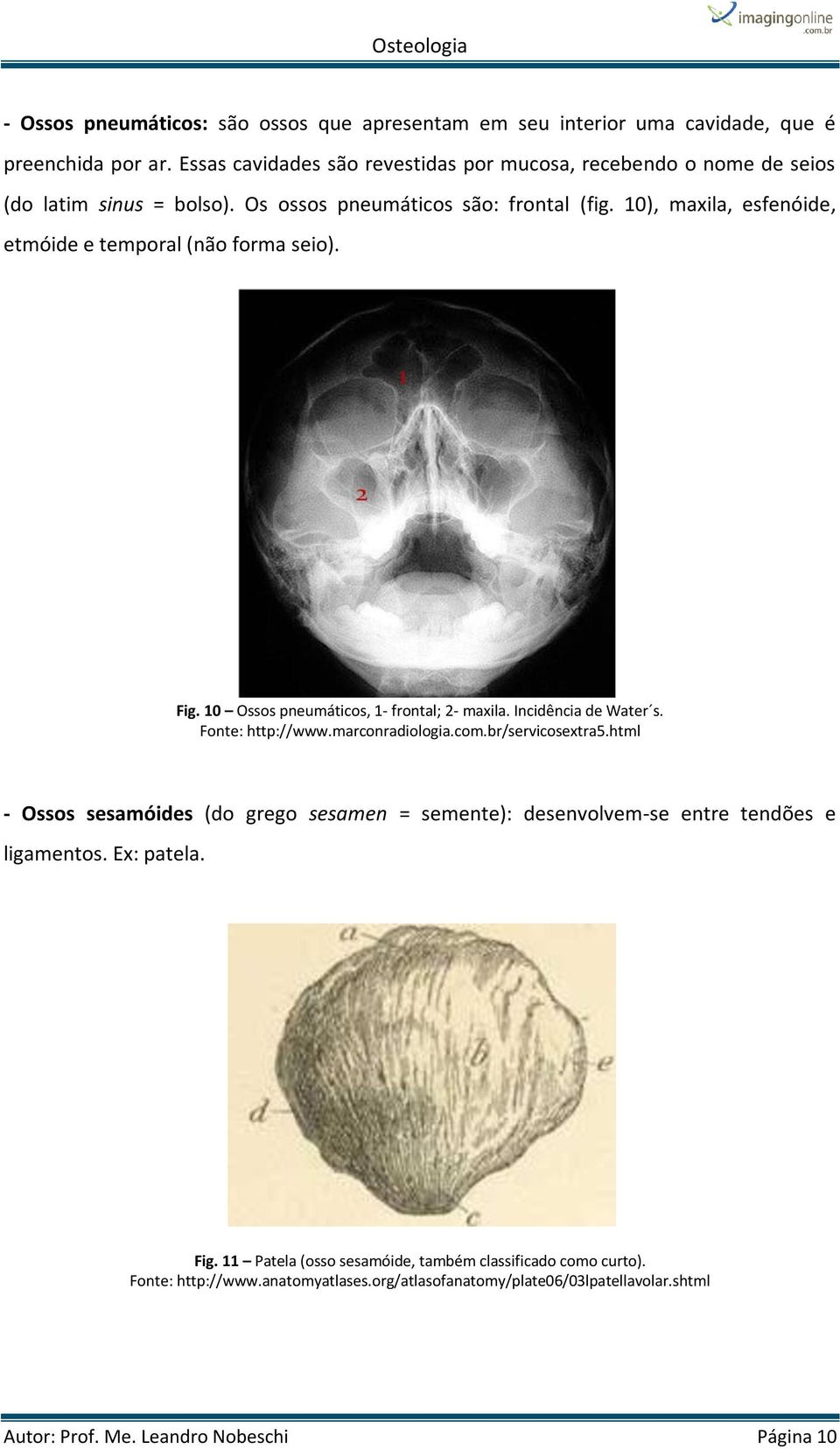 10), maxila, esfenóide, etmóide e temporal (não forma seio). Fig. 10 Ossos pneumáticos, 1- frontal; 2- maxila. Incidência de Water s. Fonte: http://www.marconradiologia.com.
