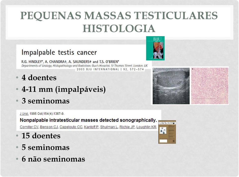 (impalpáveis) 3 seminomas 15