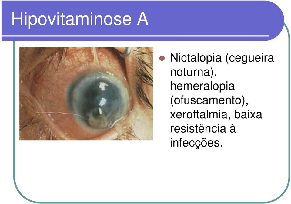hemeralopia (ofuscamento),