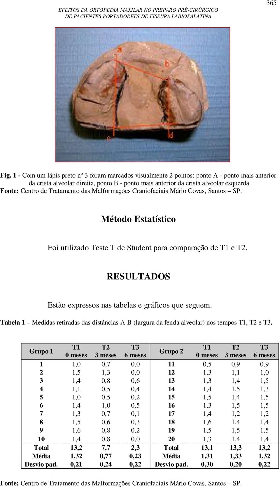 Tabela 1 Medidas retiradas das distâncias A-B (largura da fenda alveolar) nos tempos T1, T2 e T3.