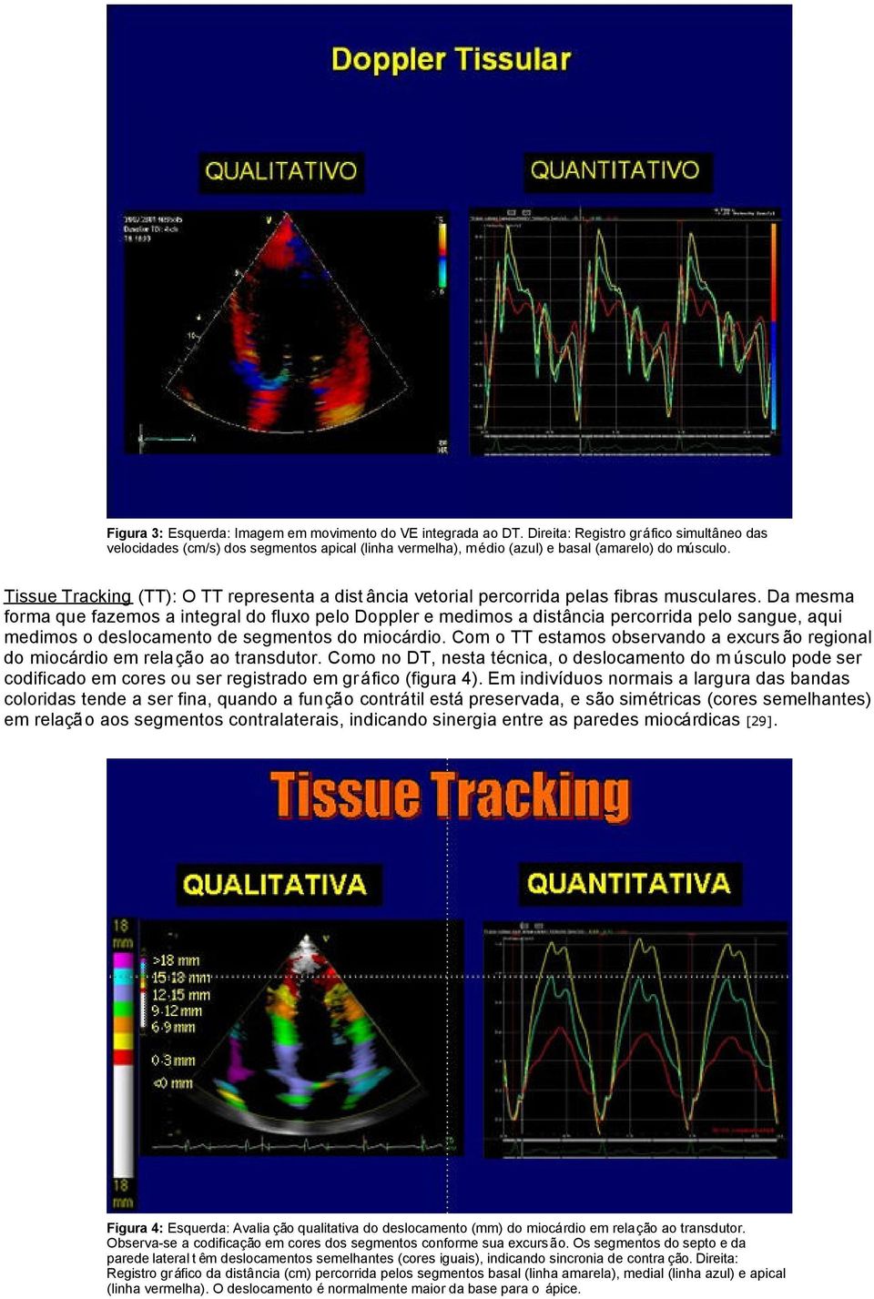 Tissue Tracking (TT): O TT representa a dist ância vetorial percorrida pelas fibras musculares.