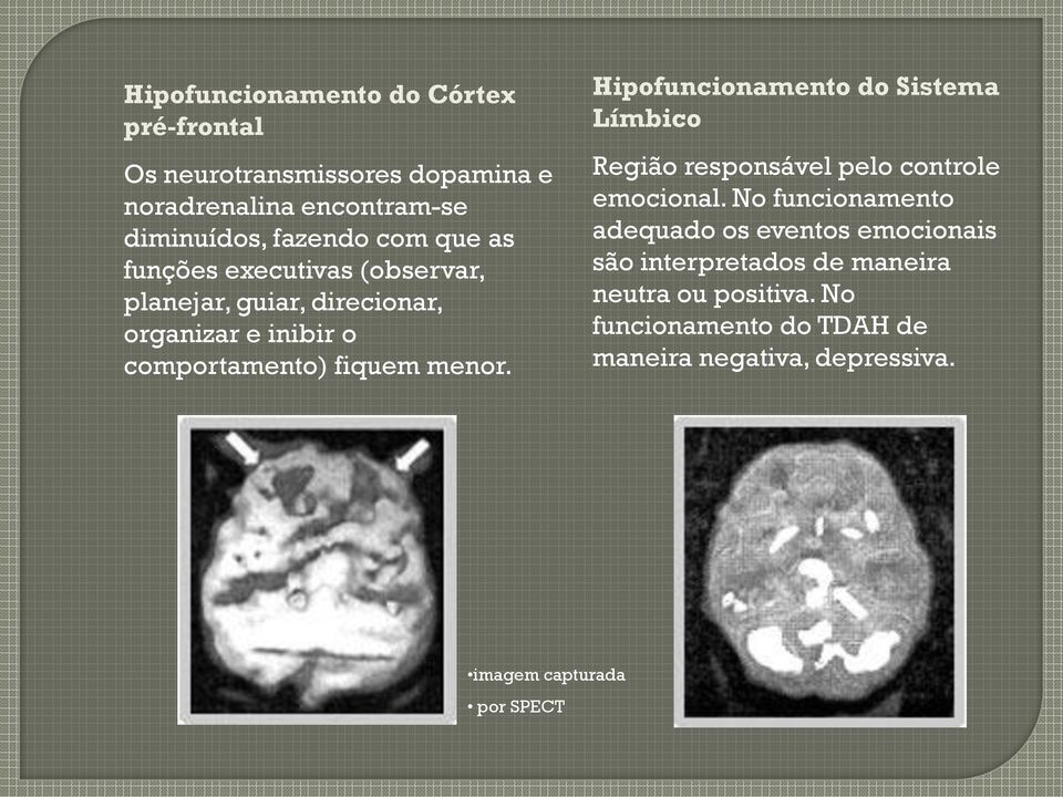 Hipofuncionamento do Sistema Límbico Região responsável pelo controle emocional.