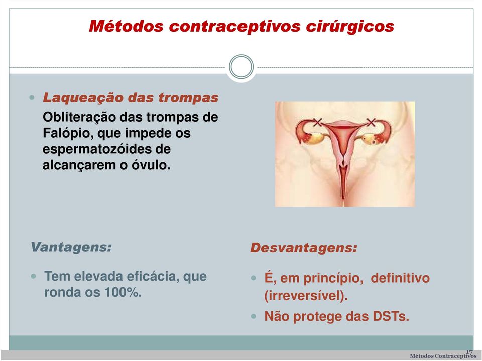 espermatozóides de alcançarem o óvulo.