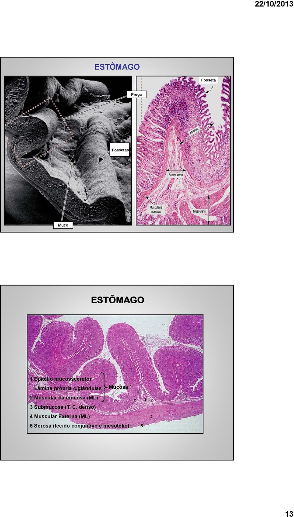 Muscular da mucosa (ML) 3 Submucosa (T. C.