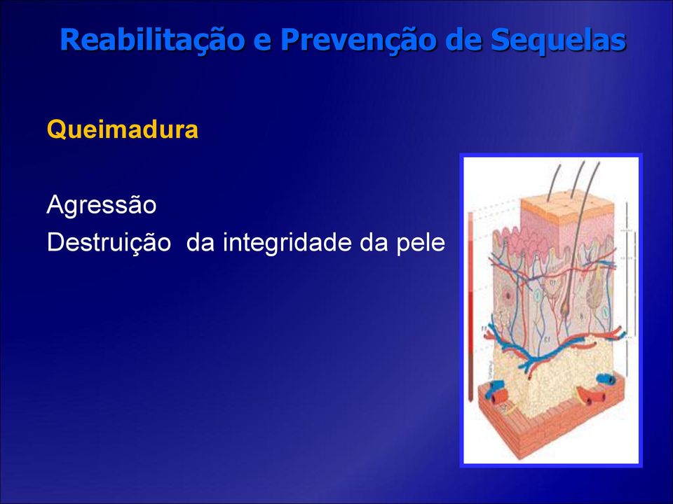 Destruição da