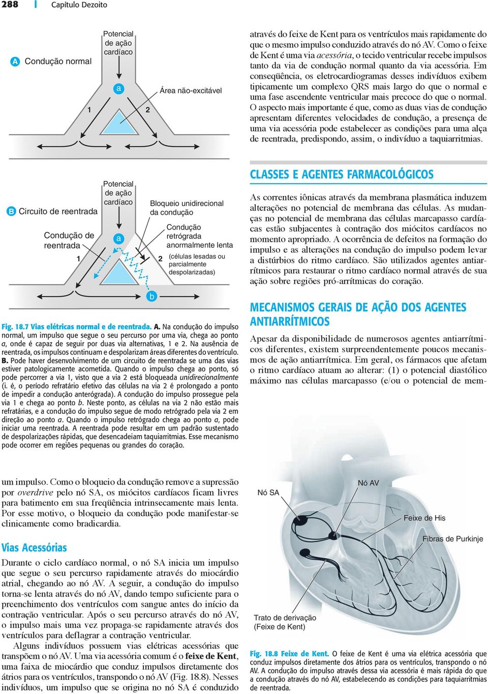 Em conseqüência, os eletrocardiogramas desses indivíduos exibem tipicamente um complexo QRS mais largo do que o normal e uma fase ascendente ventricular mais precoce do que o normal.