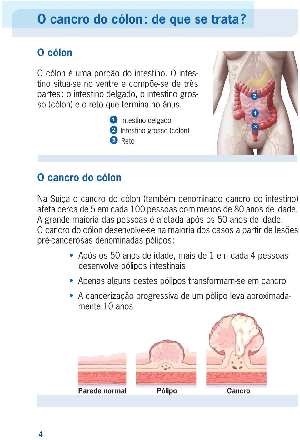 1 2 3 Intestino delgado Intestino grosso (cólon) Reto 2 1 3 O cancro do cólon Na Suíça o cancro do cólon (também denominado cancro do intestino) afeta cerca de 5 em cada 100 pessoas com menos de 80
