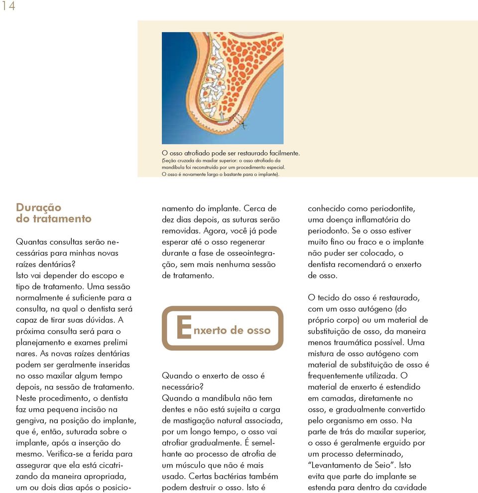 Duração do tratamento Quantas consultas serão necessárias para minhas novas raízes dentárias? Isto vai depender do escopo e tipo de tratamento.