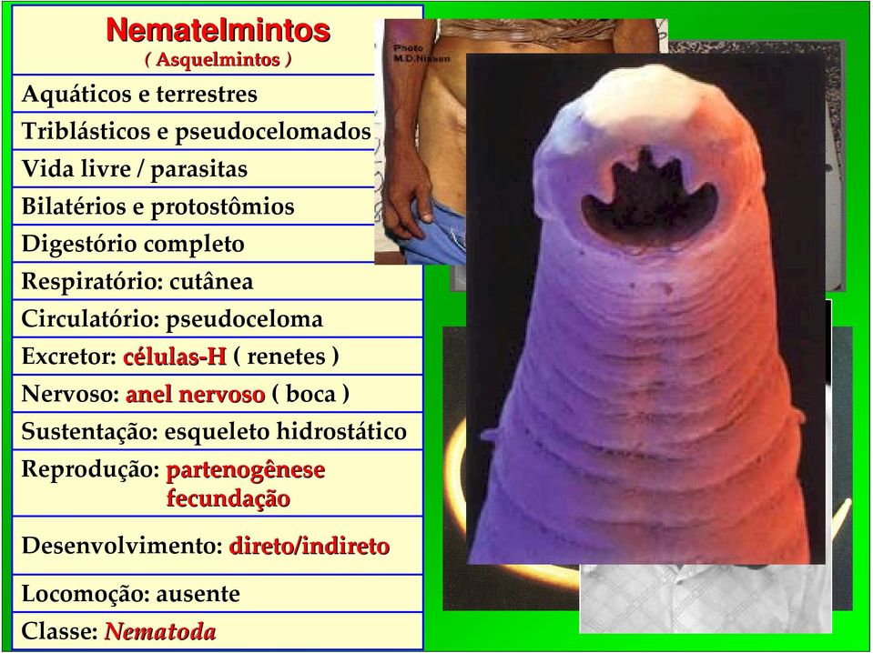 pseudoceloma Excretor: células H ( renetes ) Nervoso: anel nervoso ( boca ) Sustentação: esqueleto