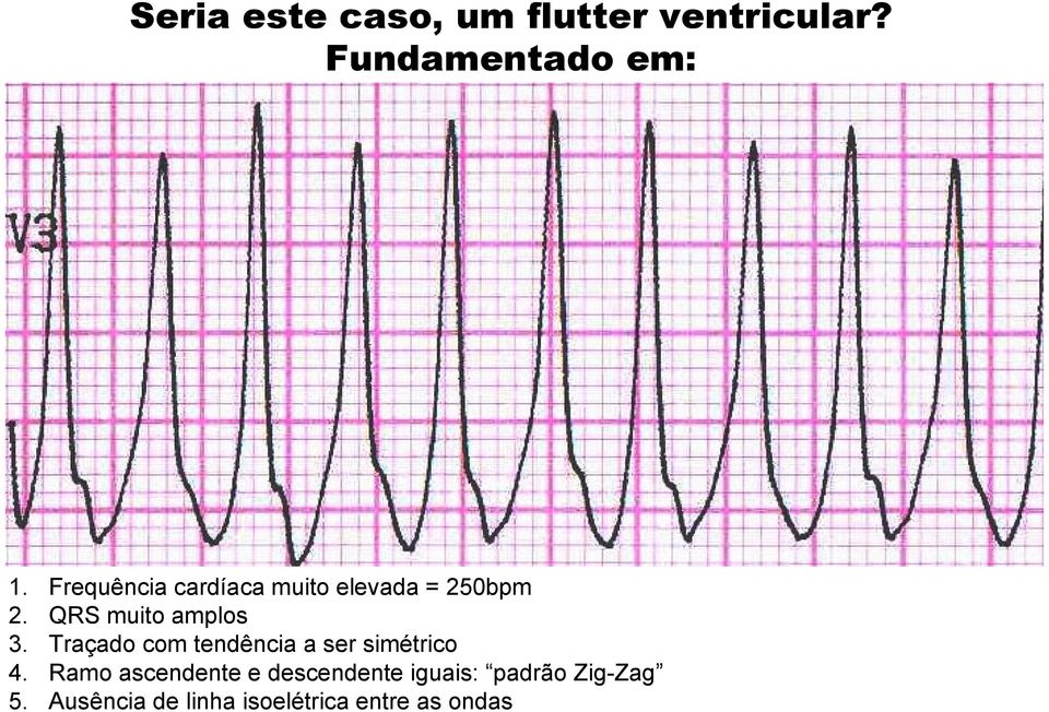 Traçado com tendência a ser simétrico 4.