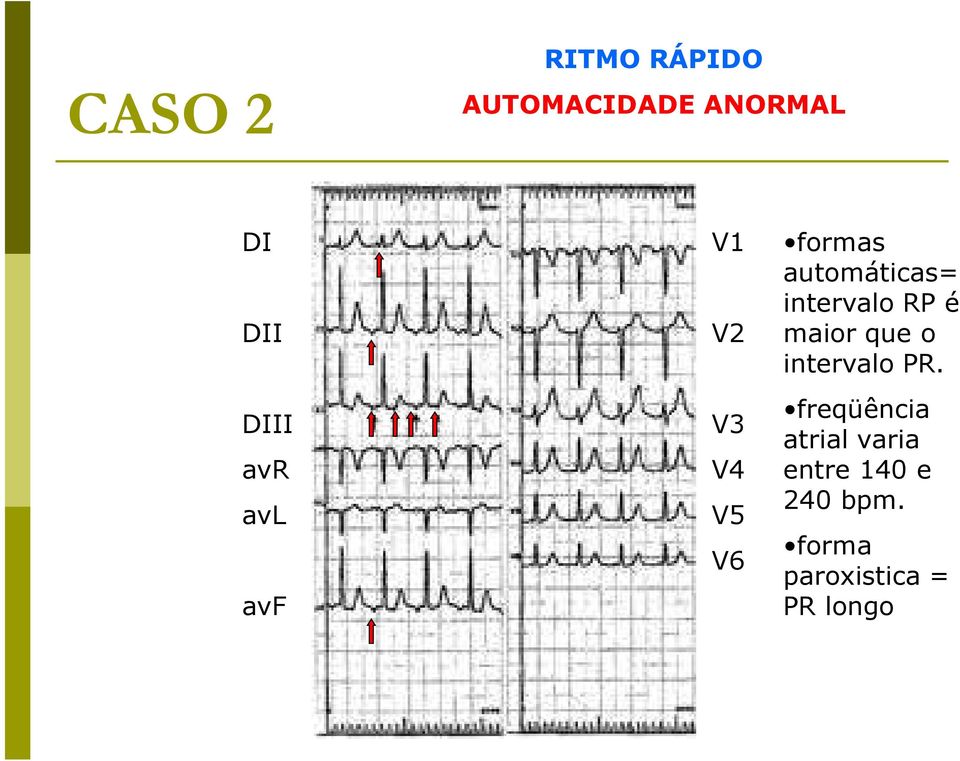 intervalo RP é maior que o intervalo PR.