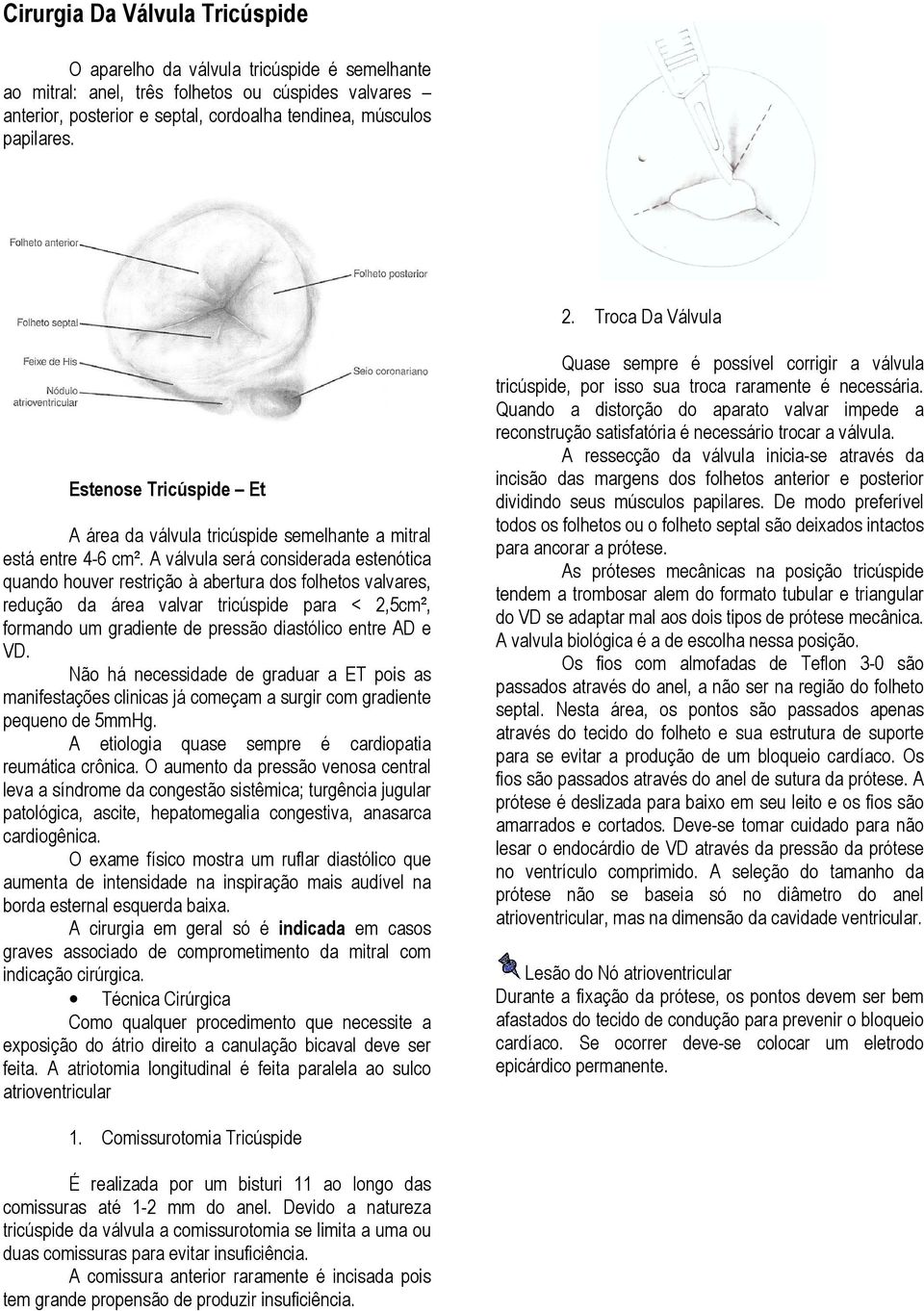 A válvula será considerada estenótica quando houver restrição à abertura dos folhetos valvares, redução da área valvar tricúspide para < 2,5cm², formando um gradiente de pressão diastólico entre AD e