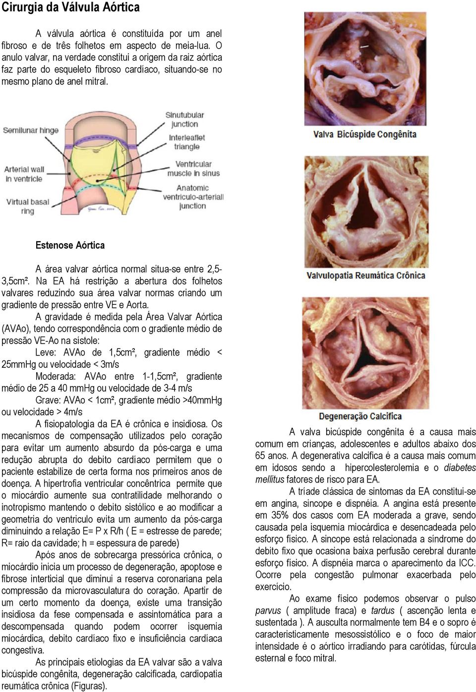 Estenose Aórtica A área valvar aórtica normal situa-se entre 2,5-3,5cm².