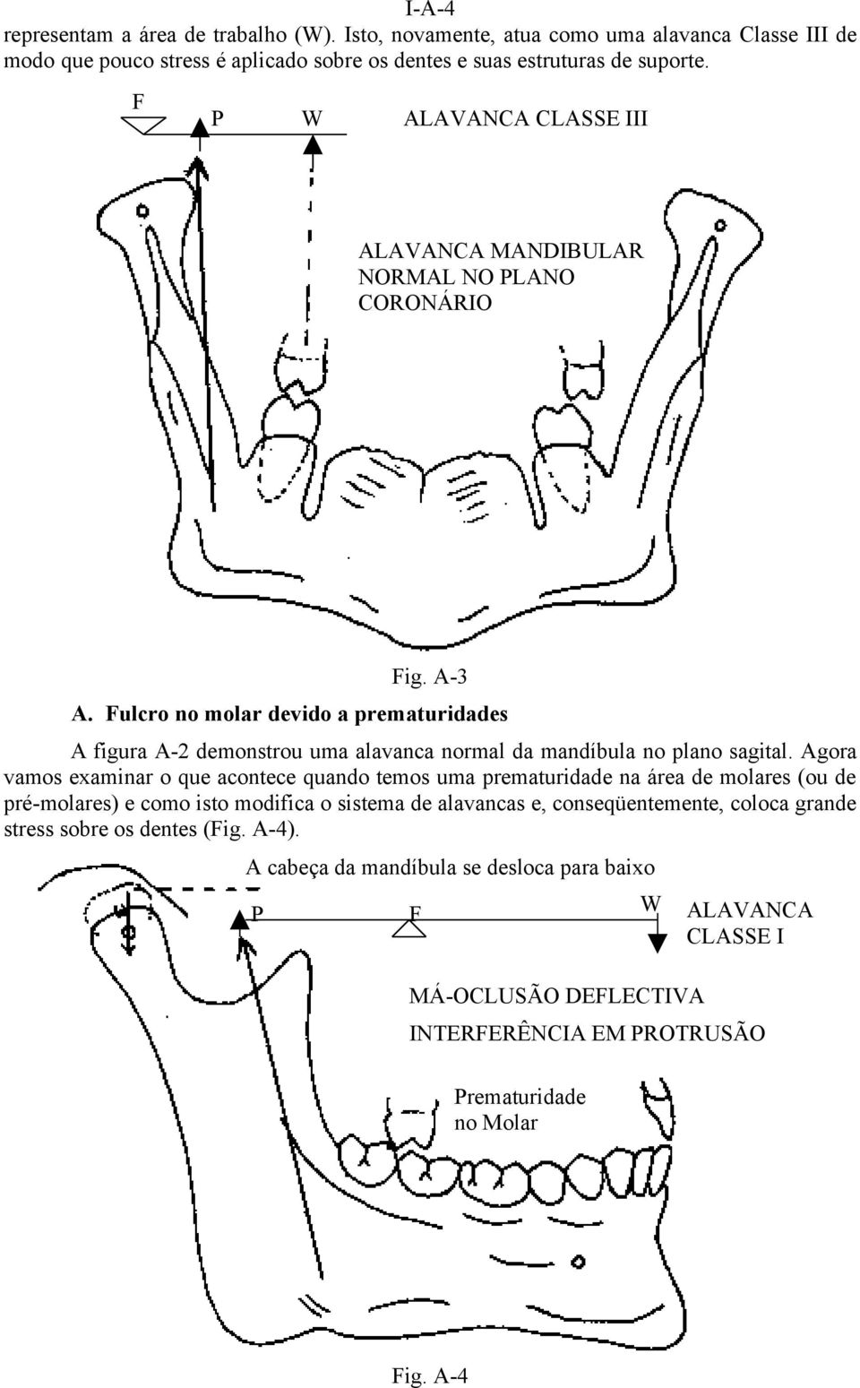 Fulcro no molar devido a prematuridades A figura A-2 demonstrou uma alavanca normal da mandíbula no plano sagital.