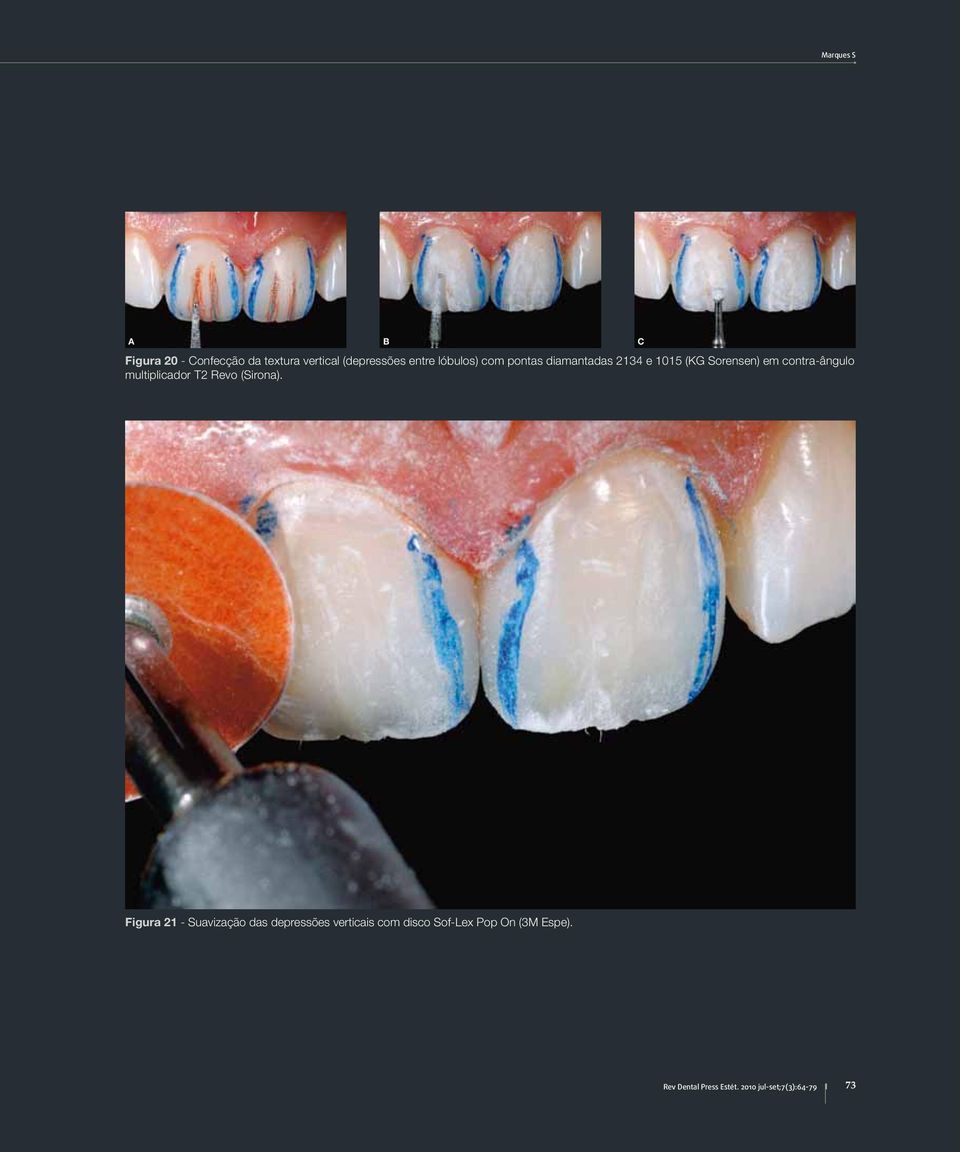 multiplicador T2 Revo (Sirona).