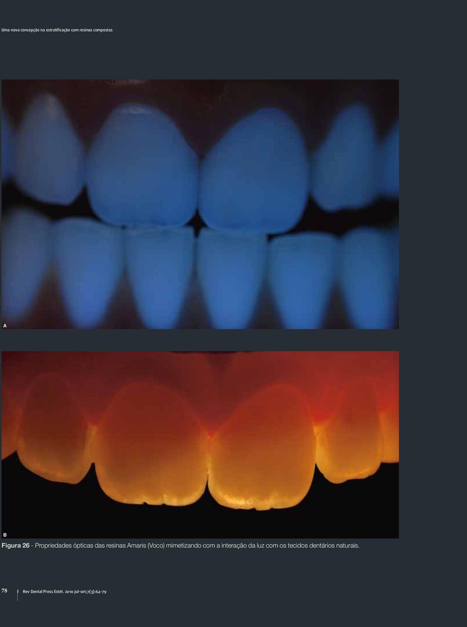 mimetizando com a interação da luz com os tecidos dentários