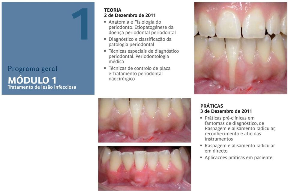 Periodontologia médica Técnicas de controlo de placa e Tratamento periodontal nãocirúrgico PRÁTICAS 3 de Dezembro de 2011 Práticas pré-clínicas em