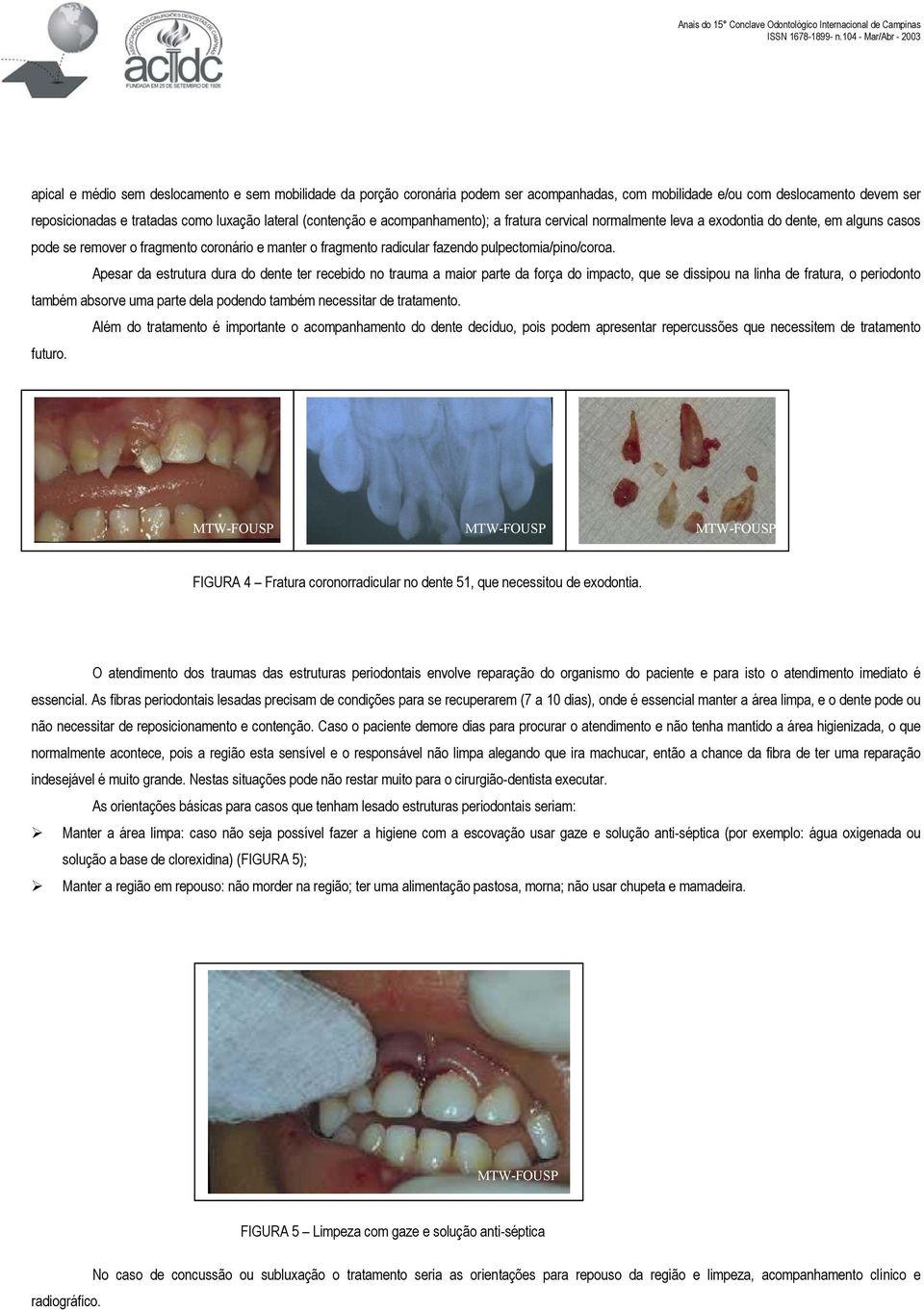 Apesar da estrutura dura do dente ter recebido no trauma a maior parte da força do impacto, que se dissipou na linha de fratura, o periodonto também absorve uma parte dela podendo também necessitar