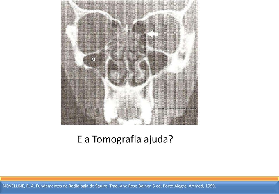 Fundamentos de Radiologia de