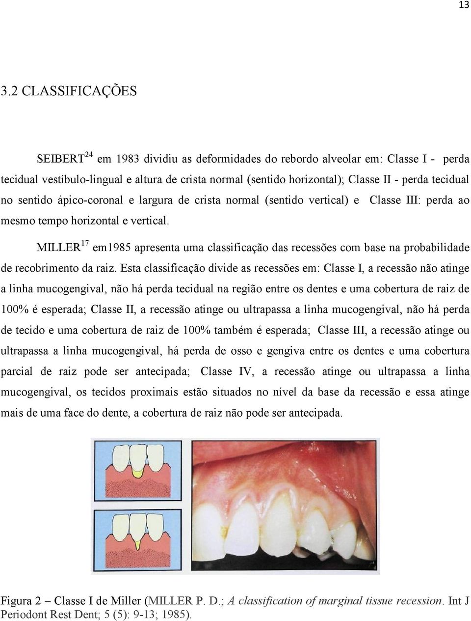 MILLER 17 em1985 apresenta uma classificação das recessões com base na probabilidade de recobrimento da raiz.