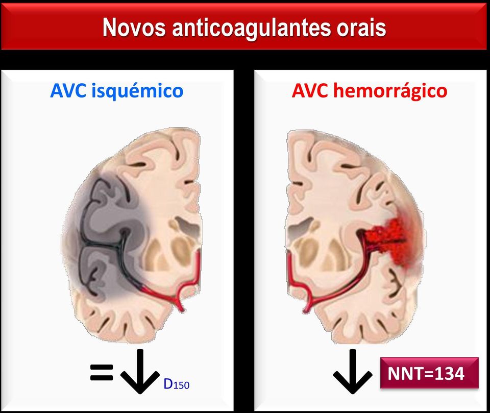 orais AVC